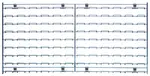 Quantum Food Service WLP-1836C Wire Louvered Panel